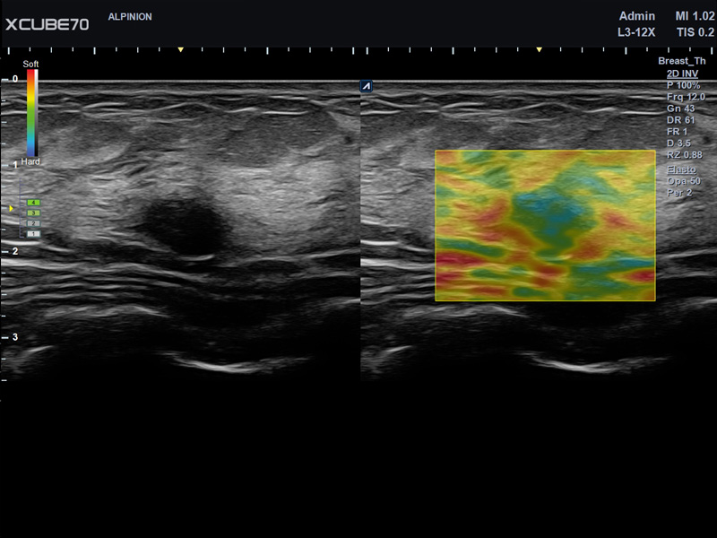 Liver in CF mode