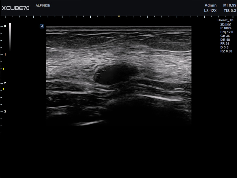 Liver in CF mode