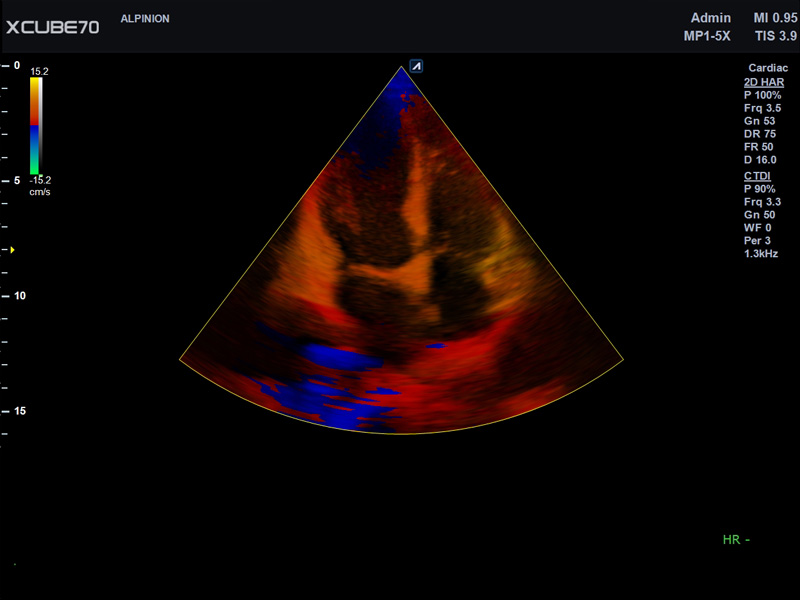 Liver in CF mode