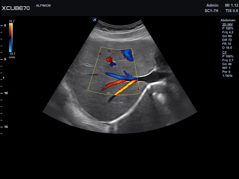 Liver in CF mode