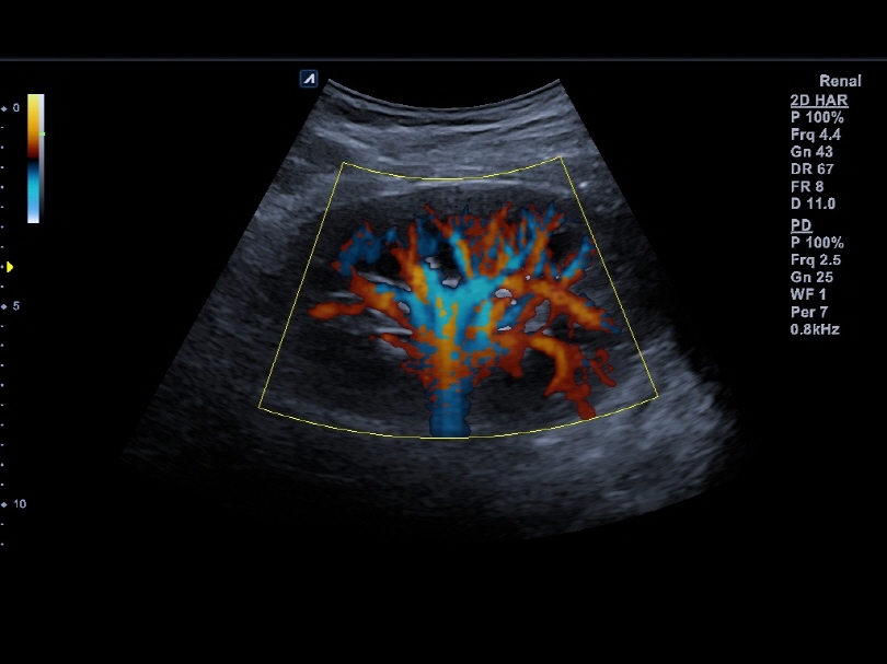 Liver in CF mode