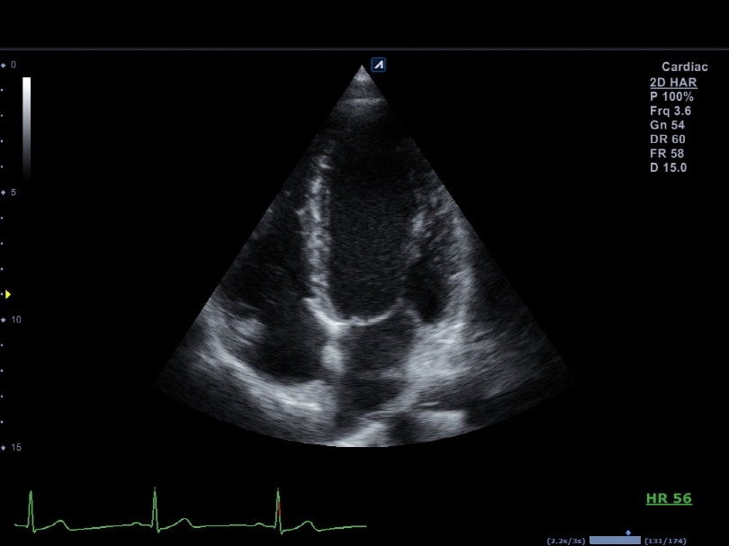 Liver in CF mode