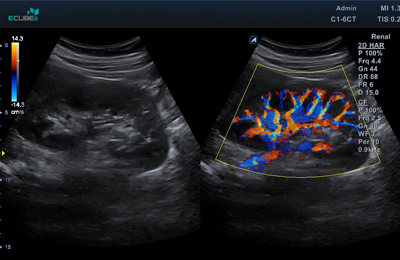 Ultrasound Image