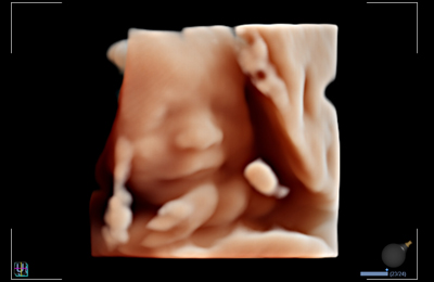 Live HQ image