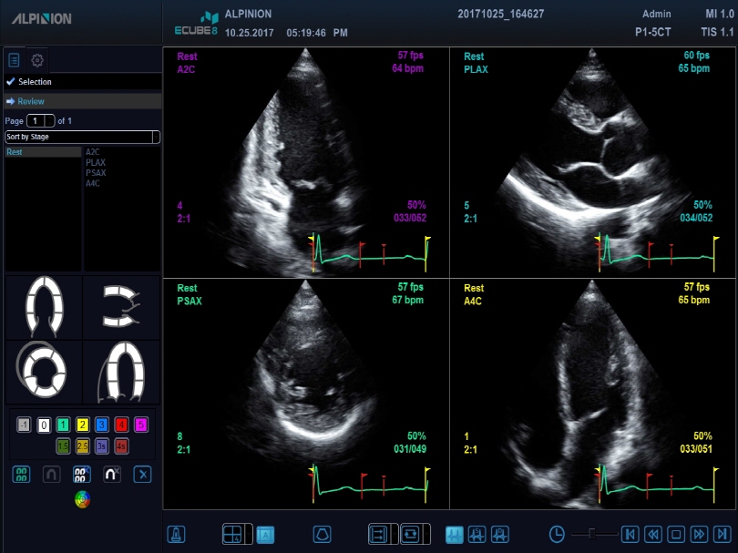 Liver in CF mode