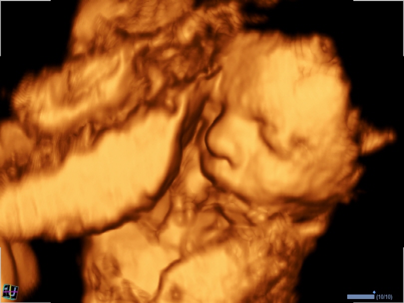 Liver in CF mode