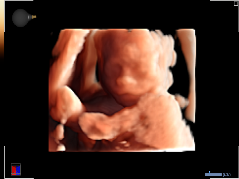 Liver in CF mode