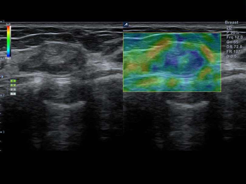 Liver in CF mode