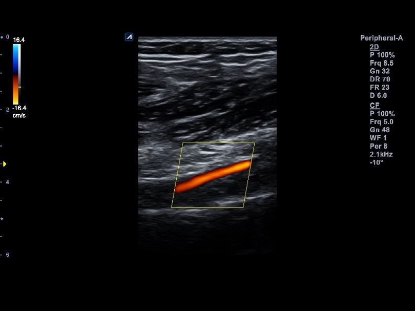 Liver in CF mode