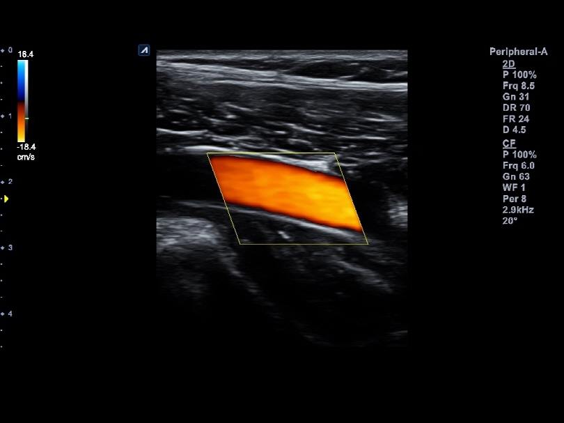 Liver in CF mode