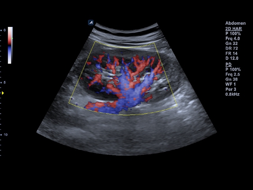 Liver in CF mode