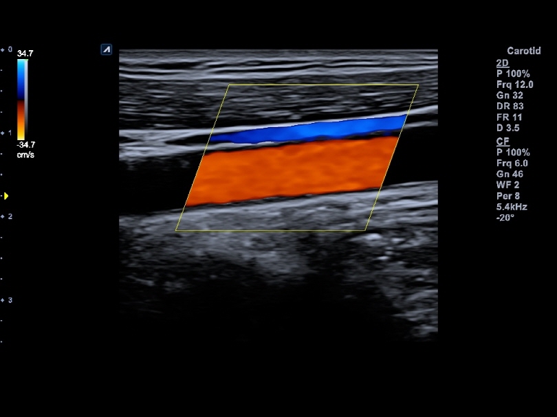Liver in CF mode