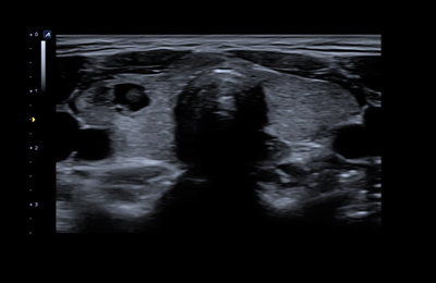 Ultrasound Image