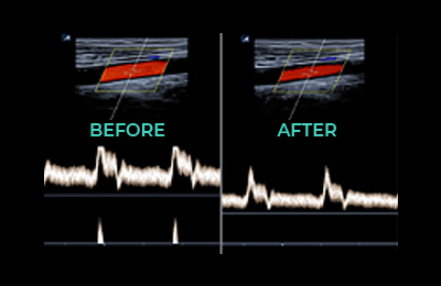 Ultrasound Image