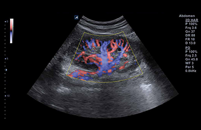 Ultrasound Image