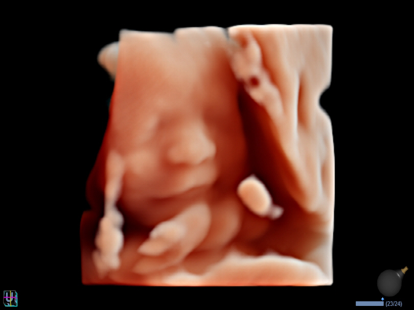 Liver in CF mode