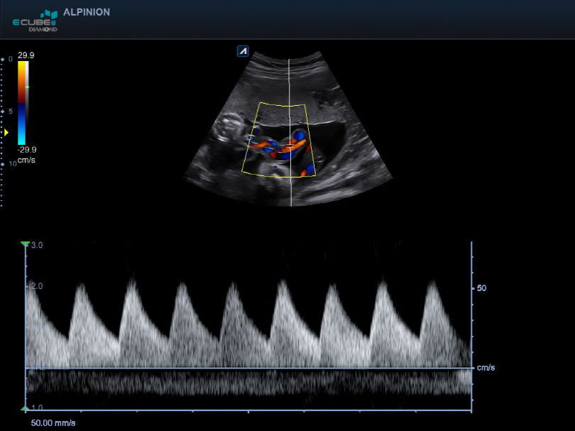 Liver in CF mode
