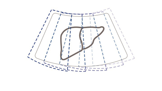 Auto IMT image