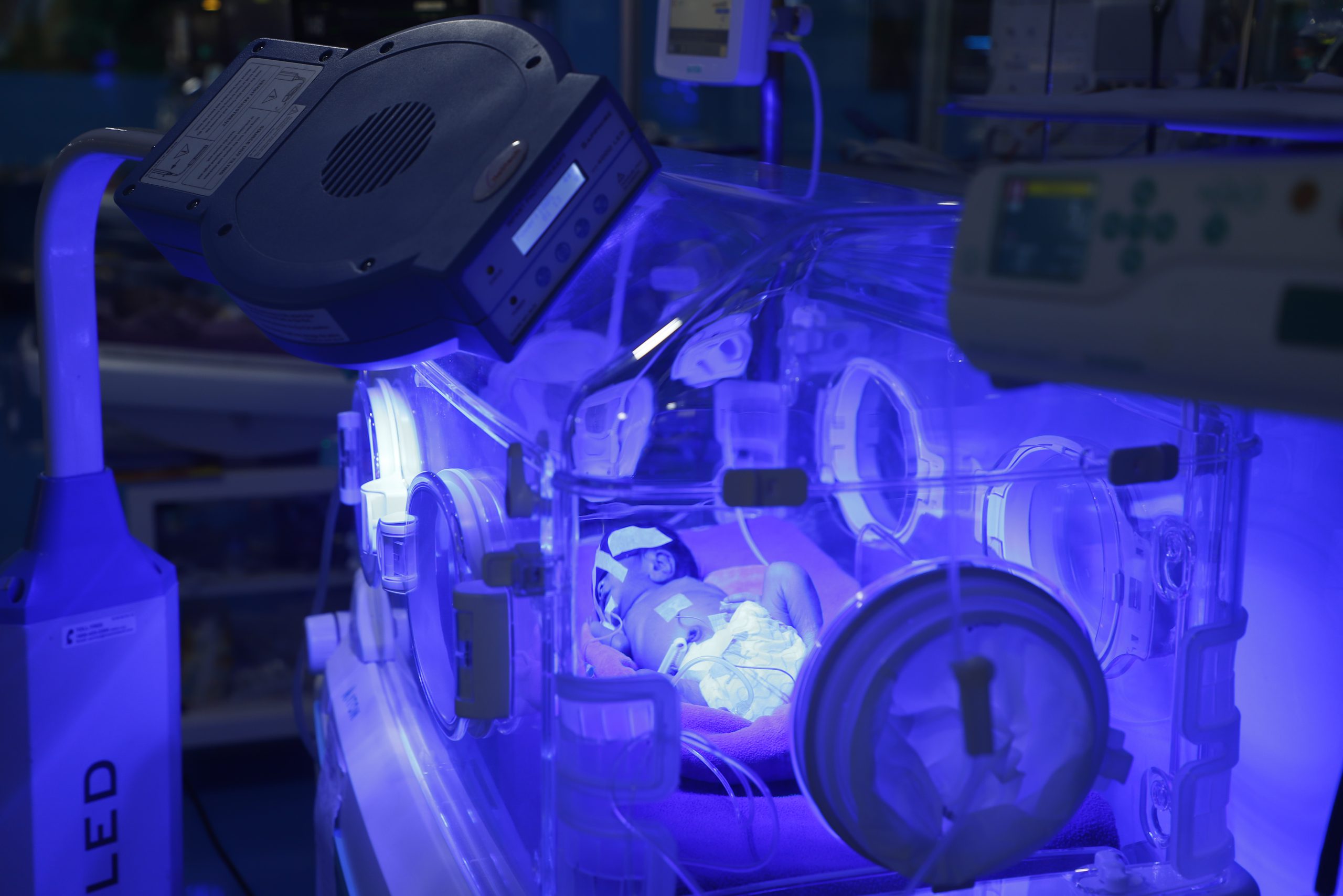 Transba NICU equipment