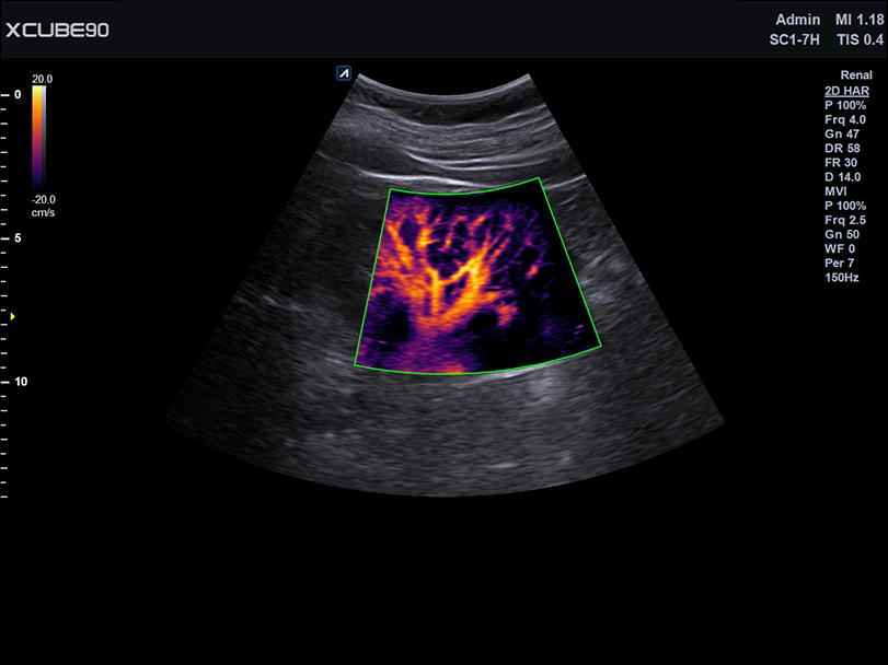 Kidney X+Microview(2)