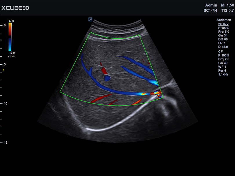 Liver in CF mode