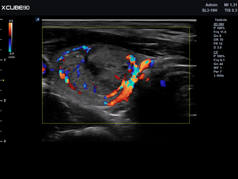 Thyroid module in CF mode