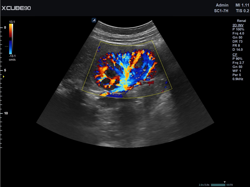 Kidney in CF mode